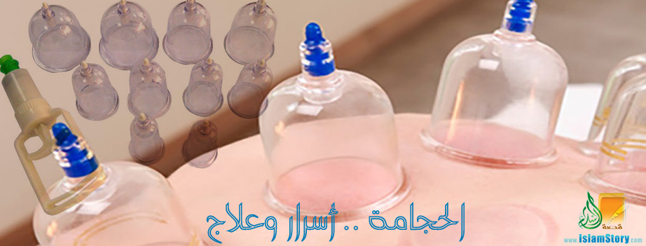 الحجامة .. أسرار وعلاج